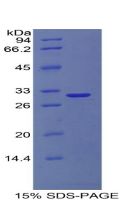 Ⅳ型胶原α1(COL4a1)重组蛋白